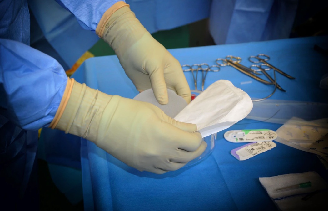 Riesgos de las cirugías plásticas: ¿En qué fijarse?, Wam Center